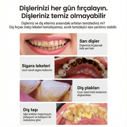 Ultrasonik Diş Taşı Temizleme Cihazı ve Fırça Seti